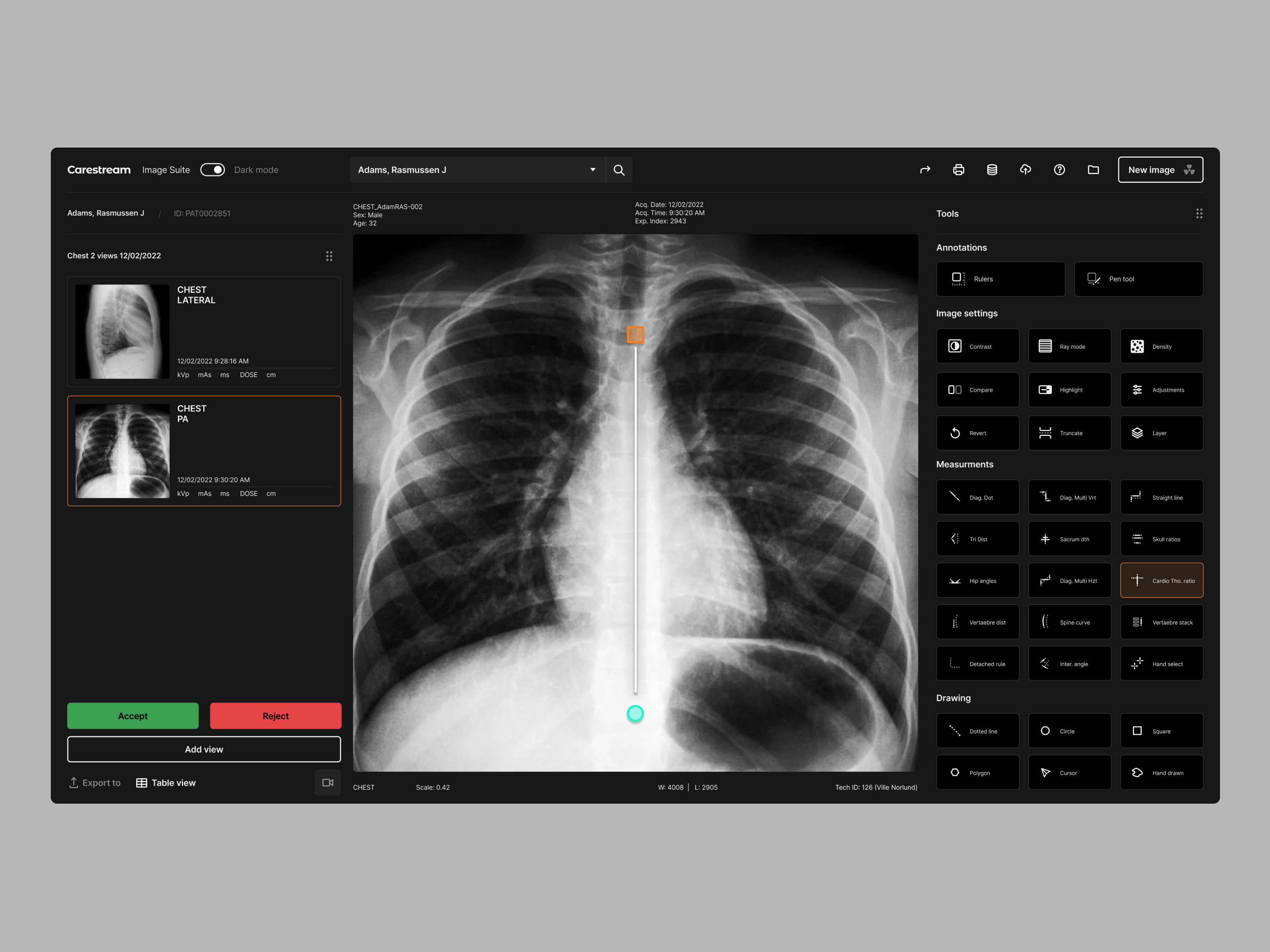 20048811-medical-imagery-software.png